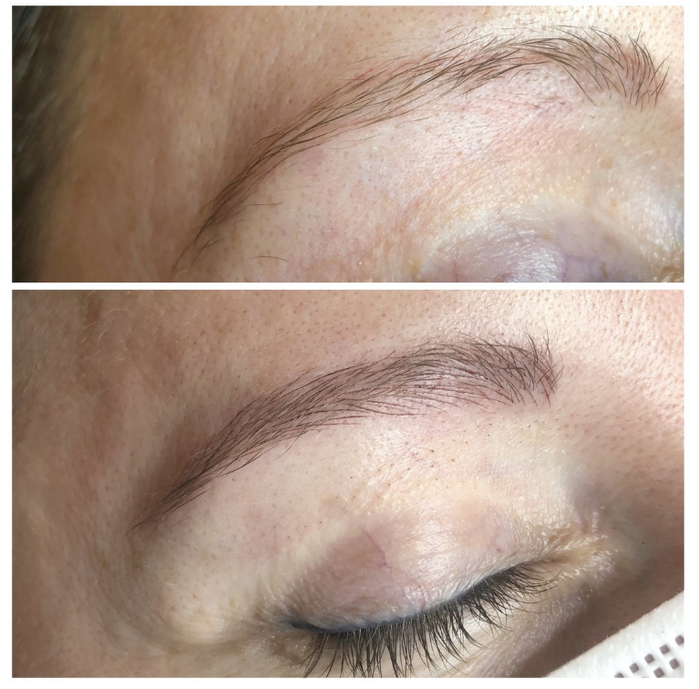 U18 Microblading Nadeln – 50 Stück, 0,18 Mm, Für Augenbrauen, Lippen, Tattoos, Steril